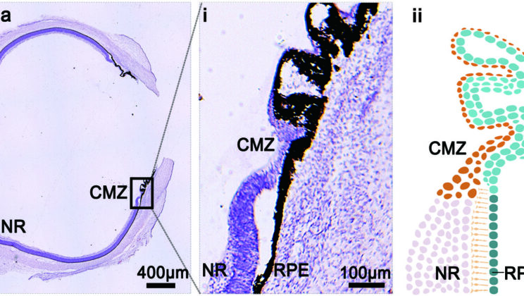 Discovery of Human Retinal Stem-Like Cells Brings Hope for Vision Restoration