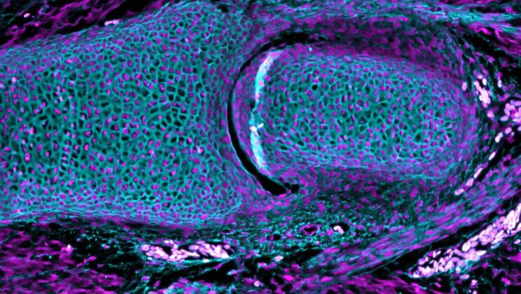 Synovial Joints Evolved in Ancient Jawed Fish, Study Finds