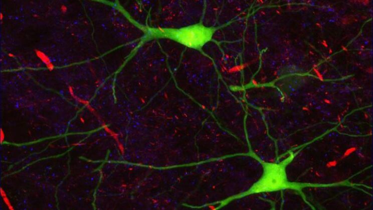 Neural Interfaces: Connecting Brains to Computers