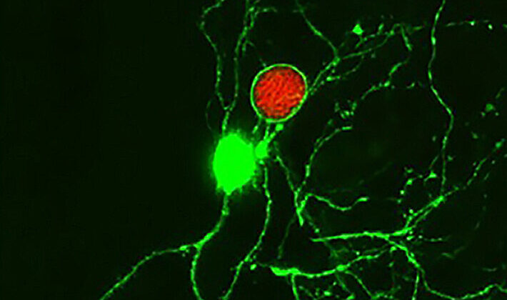 Study Reveals Immune System’s Active Role Against Latent Toxoplasma Gondii