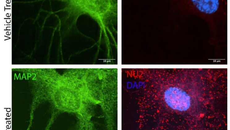 NU-9 Demonstrates Potential in Neurodegenerative Disease Treatment