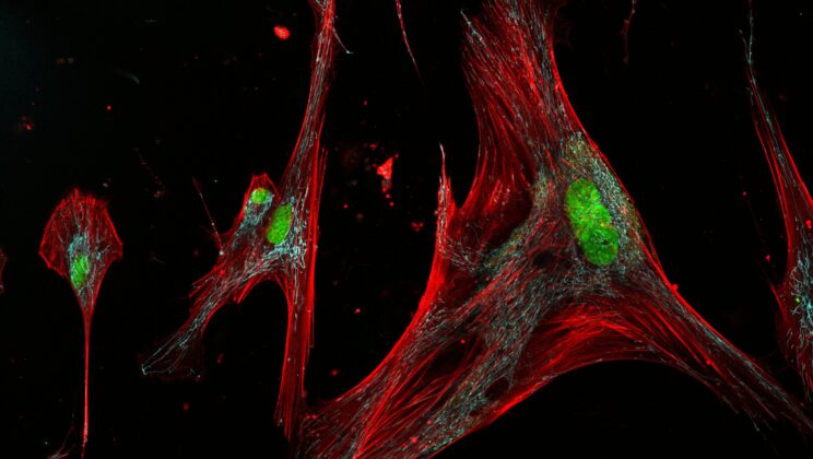 The Secret Lives of Zombie Cells