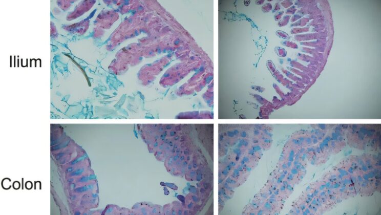 One Gene, Two Catastrophes: How a Single Mutation Disrupts Both Immunity and Brain Development
