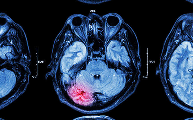 The Brain’s Plasticity: How Our Mind Adapts Over Time