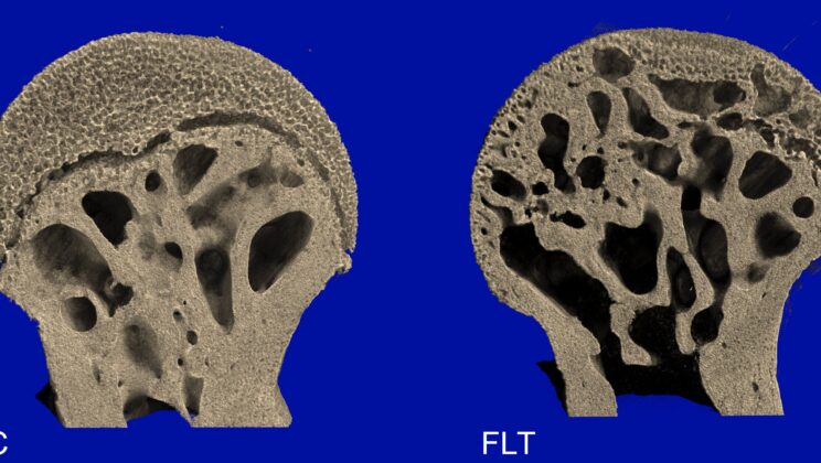 Study Reveals Femur Bone Loss in Mice Due to Space Microgravity