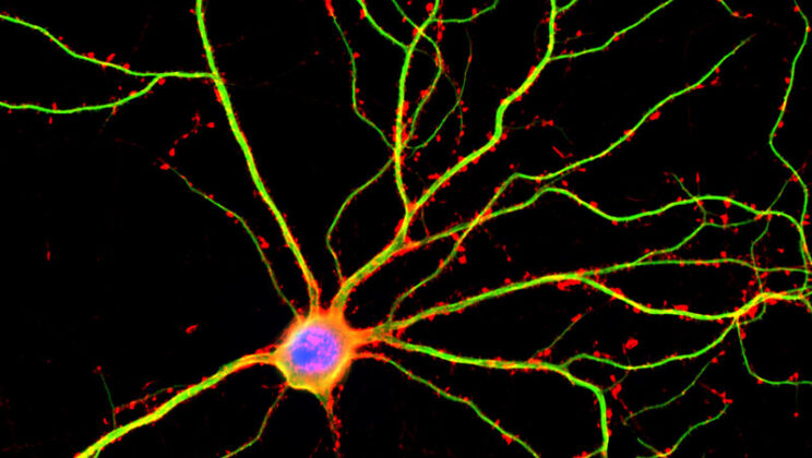 How Neural Networks Mimic the Human Brain