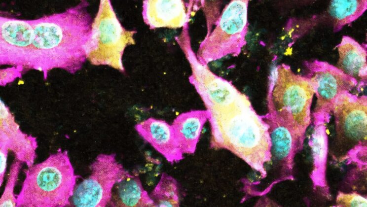 Scientists Uncover Mechanism Behind Deadly E. coli Toxin