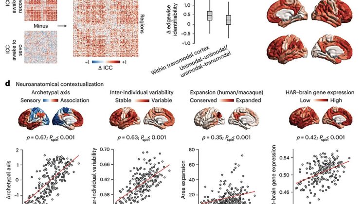 What Happens to Your Brain’s Identity Under Anesthesia? The Science of Losing and Regaining the Self