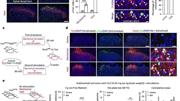 New Research Uncovers Specialized Pain Circuits in the Spinal Cord