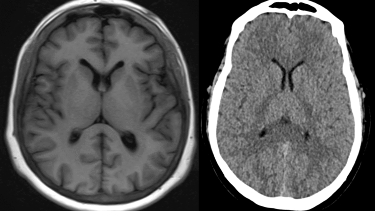 How MRI and CT Scans Work: Medical Imaging Explained