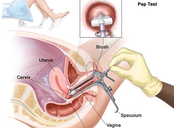 What Is a Pap Smear and Why Is It Important?