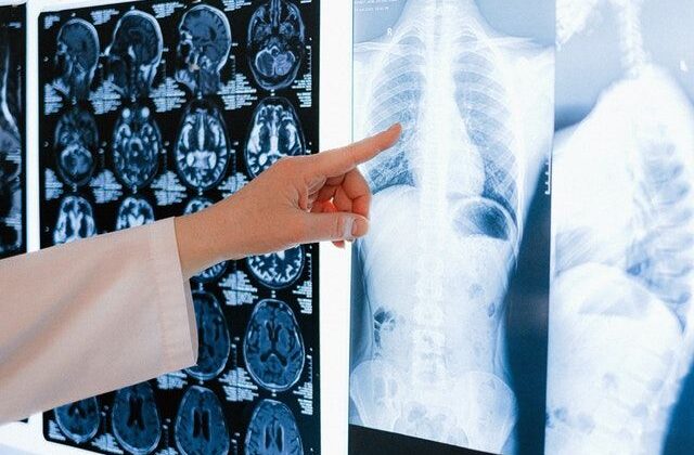 The Role of AI in Diagnosing Diseases