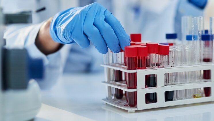 What Is Pathology? How Diseases Are Diagnosed