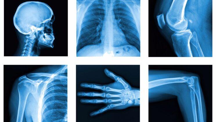 What Is Radiology? Seeing the Body Through Science