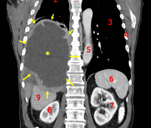 Understanding Oncology: The Medical Science of Cancer