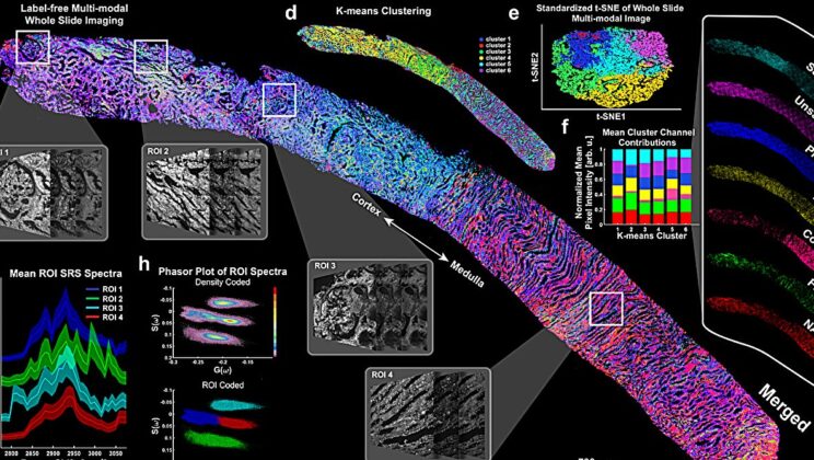 Scientists Unveil Revolutionary Imaging Technology That Sees Inside Kidneys Without Damage