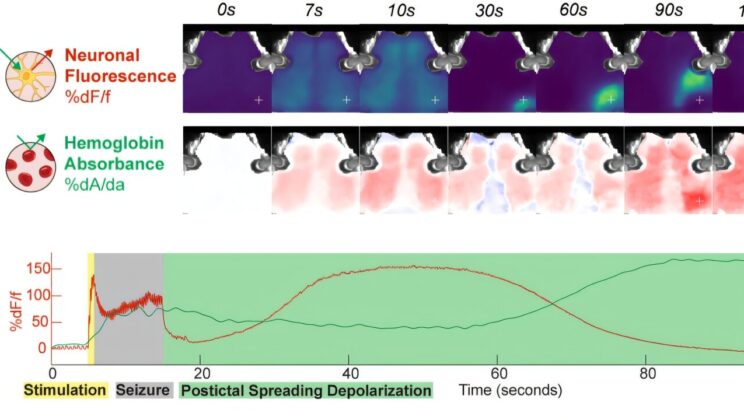 The Hidden Brain Wave Behind a Life-Saving Psychiatric Treatment