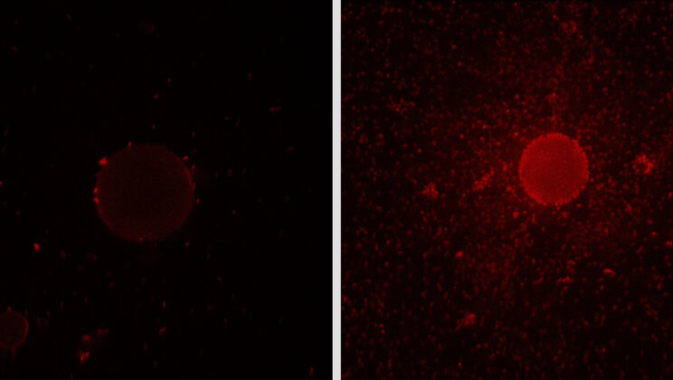 Nature’s Oil-Eater: How Alcanivorax borkumensis Fights Marine Pollution with Biochemical Precision