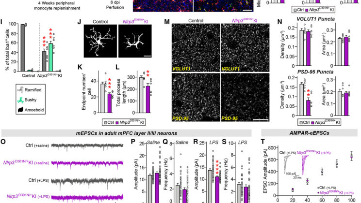 Scientists Uncover How Brain Inflammation Triggers Repetitive Behaviors in Autism and OCD