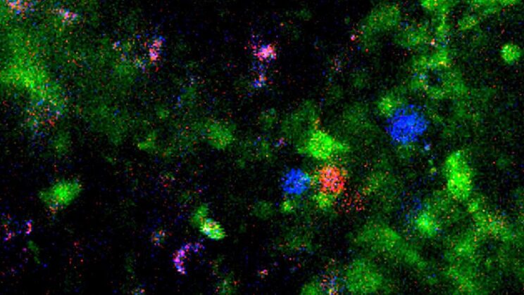 The Secret Peace Treaty Between Your Gut and Your Immune System