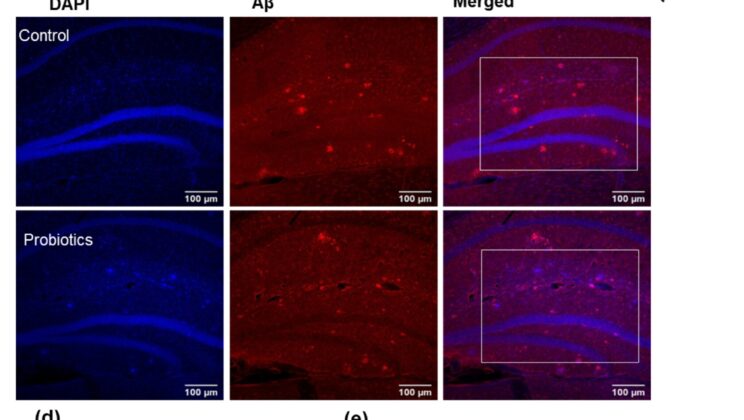 Can a Daily Drink Protect the Aging Brain? Scientists Explore a Microbial Cure for Dementia