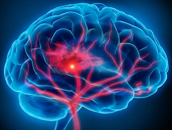 What Is Neurology? The Science of the Brain and Nerves