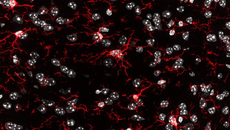 Scientists Reprogram Brain’s Immune Cells in Breakthrough Against Alzheimer’s and Parkinson’s