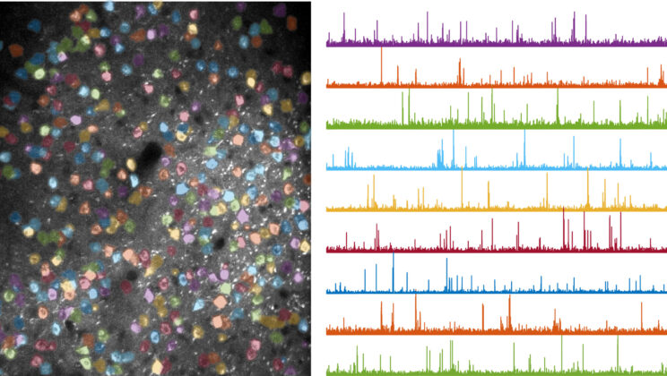 The Brain Rewired: How Learning Literally Reshapes Neural Circuits