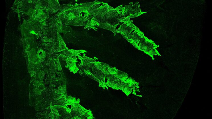 Scientists Trace Lung Cancer’s Origins to Rogue Tracheal Cells