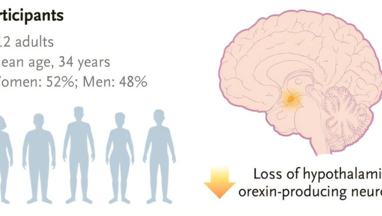 New Drug Shows Breakthrough Promise for Narcolepsy Type 1