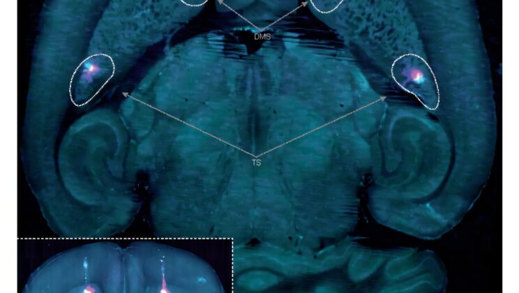 Scientists Discover a Second Brain Learning System—and It Explains Why Habits Are So Hard to Break