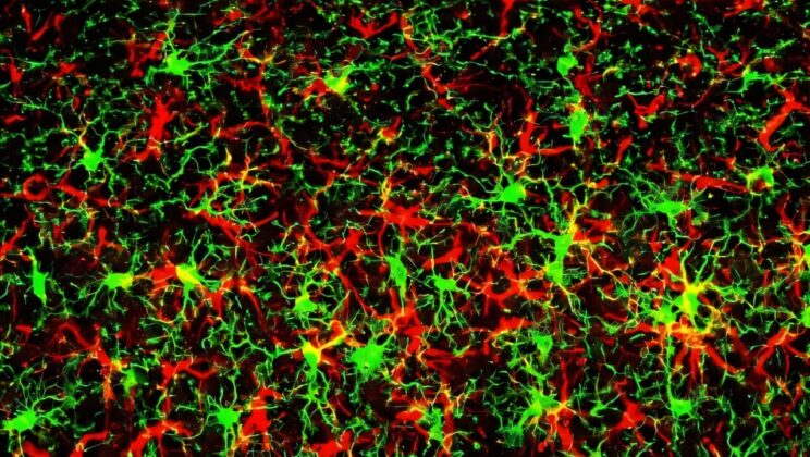 Scientists Discover the Switch That May Control Brain Decay