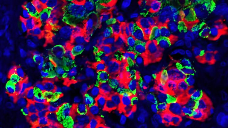 Scientists Transform the Spleen into a Diabetes-Fighting Powerhouse