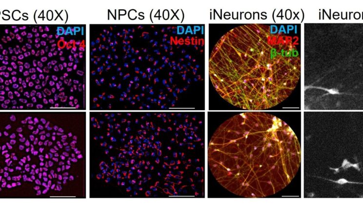 The Cellular Traffic War in Huntington’s Disease