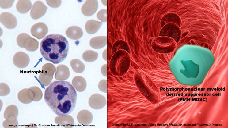 How COVID Hijacks the Body’s First Line of Defense to Worsen Disease