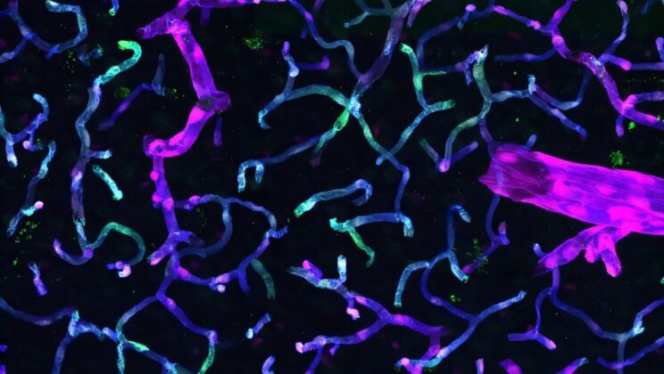 New Gene Delivery System Targets Brain Cells with Unprecedented Precision