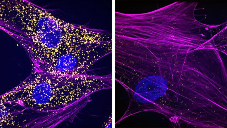 New Study Reveals How Faulty RNA Quality Control May Lead to Cancer, Neurodegeneration