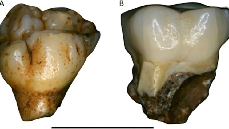 Scientists Discover Ancient Tooth Trait That Could Link Human Ancestors