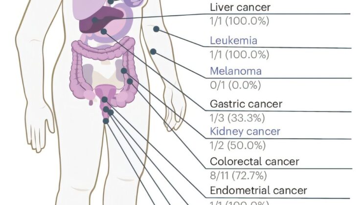 A Blood Test That Sees Cancer Before It Strikes