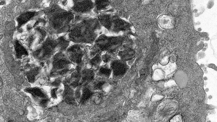 New Discovery Reveals How SARS-CoV-2 Shields Its Spike Protein for More Efficient Infection