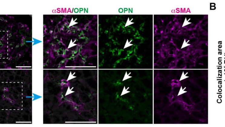 Scientists Discover How Liver Cells Whisper Signals That Spread Deadly Scarring