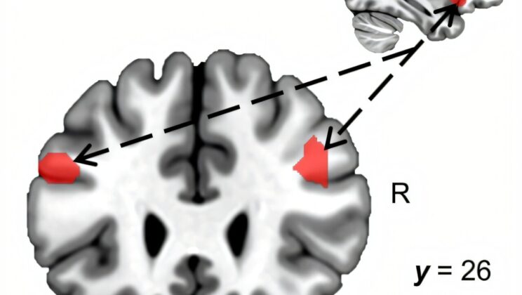 This Is What Your Brain Looks Like When It Gets Tired