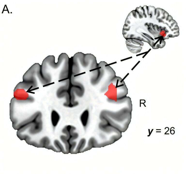 This Is What Your Brain Looks Like When It Gets Tired