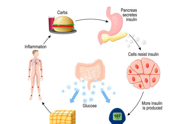 Understanding Insulin Resistance and Blood Sugar