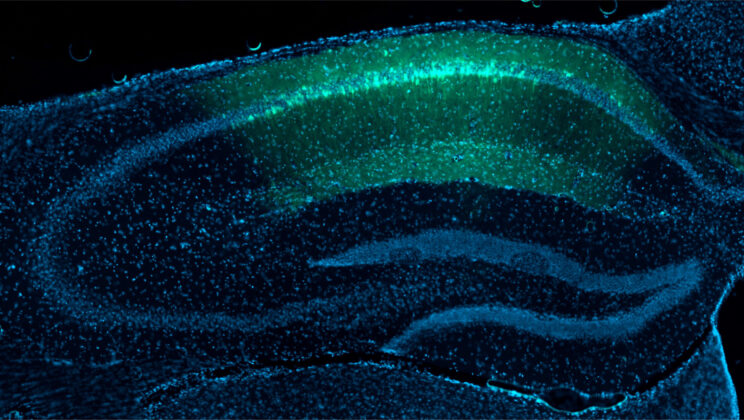 Your Brain Remembers Joy by Mapping Where It Happened