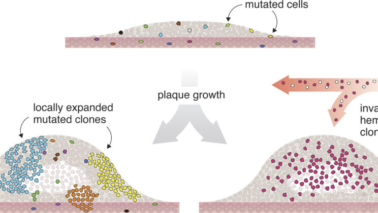 Scientists Discover Cancer-Like Cell Behavior in Heart Disease