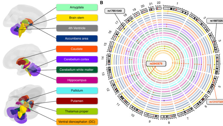 New Study Finds Brain Shape May Hold Secrets to Mental Health