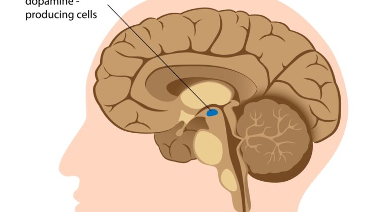 Parkinson’s Disease: Causes, Symptoms, and Research