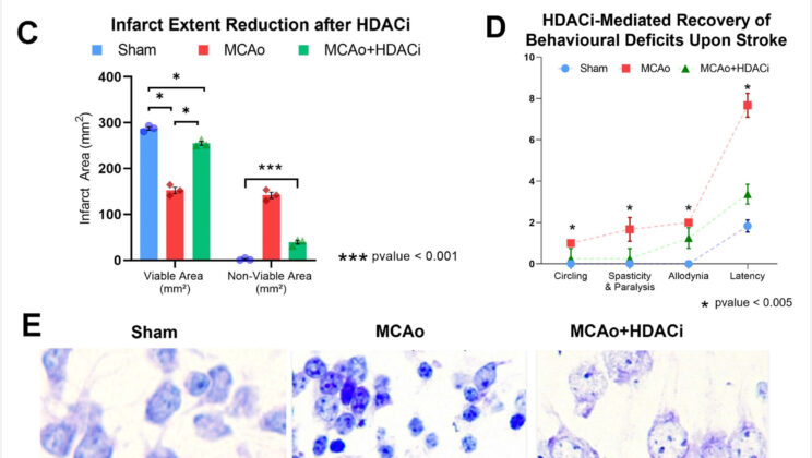 New Study Uncovers How Cancer Drugs Could Heal the Brain After Stroke