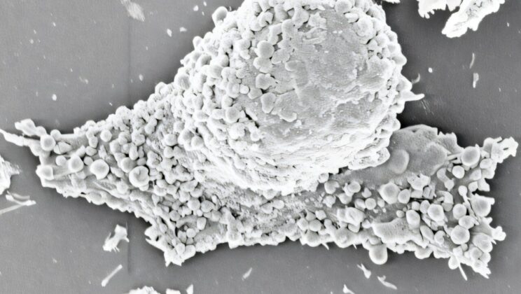 Dying Cancer Cells Hold the Secret to a Powerful New Vaccine